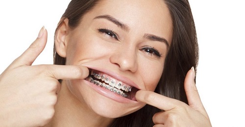 آیا ارتودنسی فقط با هدف زیبایی است؟ نگاهی علمی به تأثیر ارتودنسی بر سلامت دهان، فک و کیفیت زندگی آیا ارتودنسی فقط با هدف زیبایی است؟ نگاهی علمی به تأثیر ارتودنسی بر سلامت دهان، فک و کیفیت زندگی