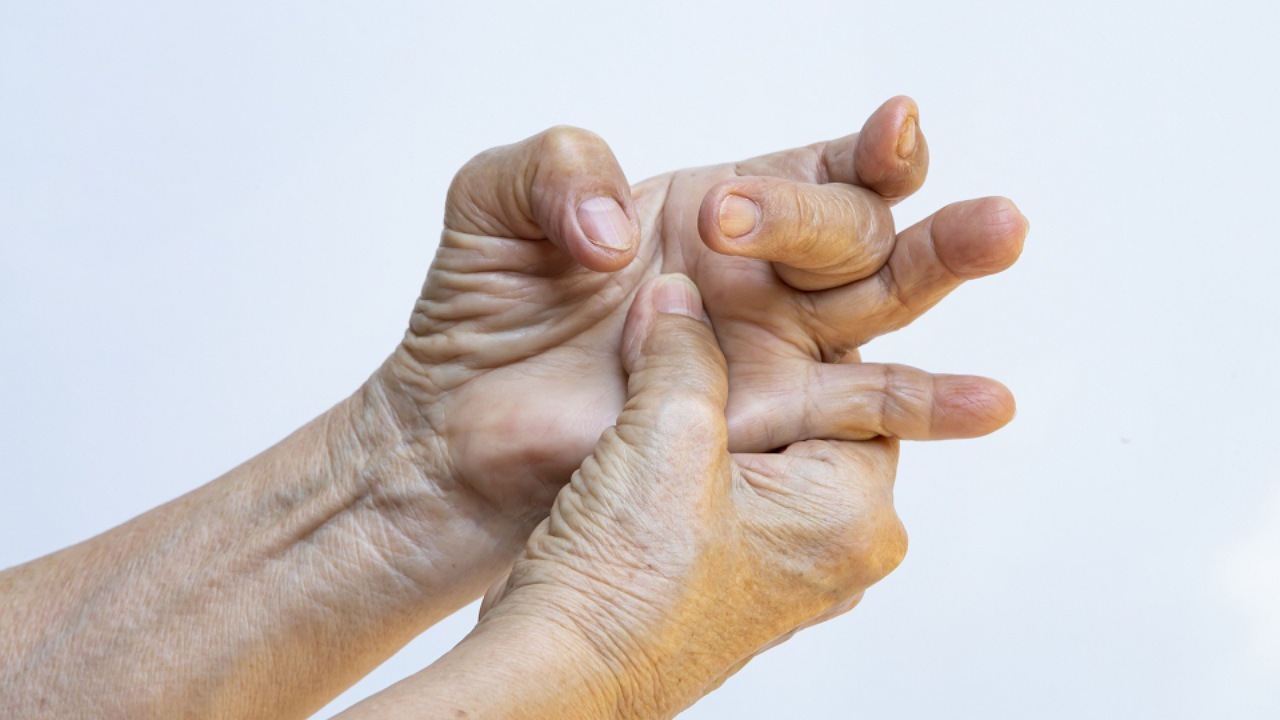 انگشت ماشه‌ای، عارضه بیماران دیابتی