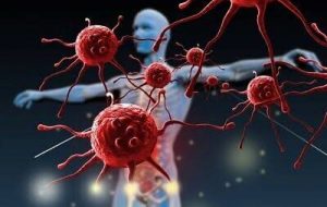 علائم سادهای که باورتان نمیشود نشانه سرطان باشد علائم سادهای که باورتان نمیشود نشانه سرطان باشد