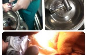 گیر کردن دست پسر دو ساله شیرازی در چرخ گوشت/ قطع انگشتان دست کودک نتیجه تلخ این حادثه بود