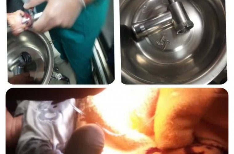 گیر کردن دست پسر دو ساله شیرازی در چرخ گوشت/ قطع انگشتان دست کودک نتیجه تلخ این حادثه بود