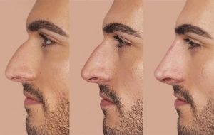 خدمات زیبایی با نتایجی شگفت انگیز