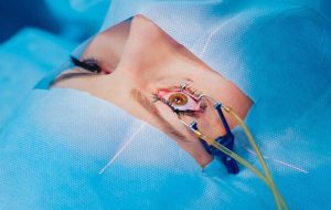 فاجعه در بیمارستان چشم پزشکی؛ ۹ بیمار پس از عمل آب مروارید نابینا شدند / وزارت بهداشت: پیگیری قضایی درباره این مسئله انجام شده / رئیس کمیسیون بهداشت مجلس: مردم را نگران نکنید؛ دلیلی ندارد که رسانه‌ها هرروز این مسئله را برجسته کنند / [این مسائل را] بزرگ نکنید