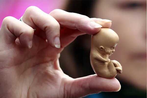 عوارض سقطهای غیرقانونی بسیار گسترده و خطرناک است عوارض سقطهای غیرقانونی بسیار گسترده و خطرناک است